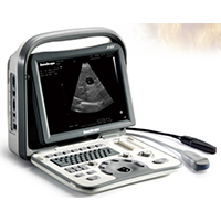 Sonoscape A6 Black/white ultrasound