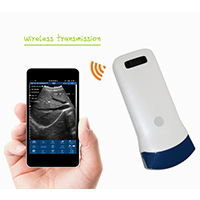 Wireless ultrasound Convex probe