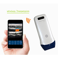 Wireless ultrasound Linear probe