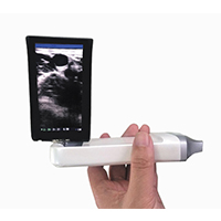 XProbe Series Built-in Screen Wireless Probe Type Ultrasound Scanner