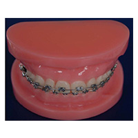 Fixed Remedy Teeth Model (normal) LT-Y10037 