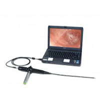 USB Series Video Endoscopy System