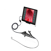 Flexible Video Cystonephroscope Nephroscope Cystoscopy Equipment Cystoscope Electronic endoscope