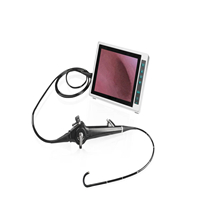 Flexible Video Choledochoscope Gallbladder endoscope In The treatment Of Cholecystolithiasis