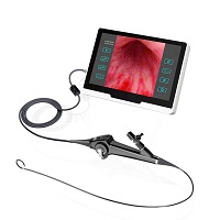High Quality Flexible Video Cystonephroscope  Nephroscope Cystoscopy Equipment Cystoscope  Electronic endoscope