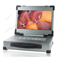 Full HD Medical Endoscope Camera System with light source for ENT/Urology/gynecology/Surgery/anesthesia ICU endoscope
