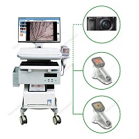 Dermoscopy Vitiligo Accurate Diagnosis skin endoscope Skin detecting instrument Vitiligo Diagnosis analyzer dermoscope